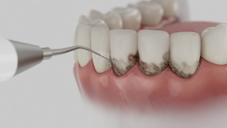 Reliable Teeth Cleaning And Checkup contractor in Baldwin County County, AL by Dentist Open Now